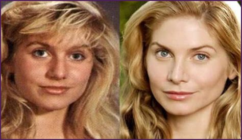 Elizabeth Mitchell Plastic Surgery Before and After