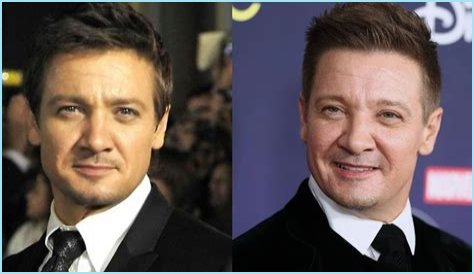 Jeremy Renner Plastic Surgery Before and After
