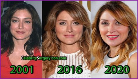 Sasha Alexander Plastic Surgery Before and After